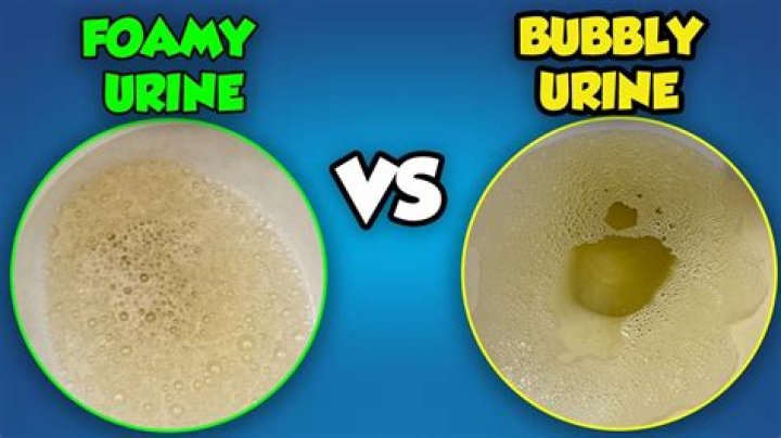 Quick Answer: Why Does Pee Bubble Up
